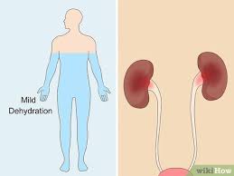 Movies games audio art portal community your feed. 6 Ways To Reduce Foamy Urine Wikihow