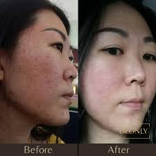 Sandalwood Optimal Cleanser