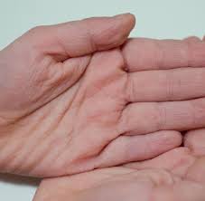 Keratin Fasern Warum Im Wasser Die Finger Schrumpeln Welt