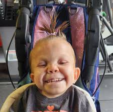 Quinn's RCDP Journey