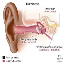 Dizziness: Causes & Treatment