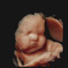 Kristen Johnson-Williams