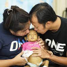 Ketto Mother Fears Her Baby S Stomach May Burst Killing Facebook
