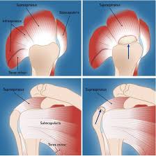 Image result for Rotator Cuff Injury