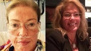 Fundraiser by Marcia DeSerres : Marcia's Heart & Lung Transplant