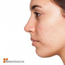 Dermogalicia Clínica Dermatológica