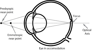 Image result for Presbyopia