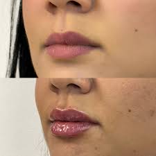 Dra. Norma Espinal. Md.Cirujano/ Md.Estetica