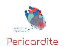Prezenta de lichid in cantitate mare poate conduce chiar la sindromul de tamponada cardiaca. Pericardite Acuta E Cronica Cause Sintomi E Cura