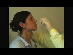 Flocked Swab Nasopharyngeal Specimen Collection Youtube
