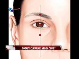 Gozalti Cukurlari Neden Olur Youtube Youtube Cilt Bakimi Gozler
