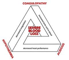 10 Things You Need To Know About Hypovolemic Shock To Save Lives