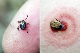 Insect Bites Guide Pictures And Treatment Advice For Bites