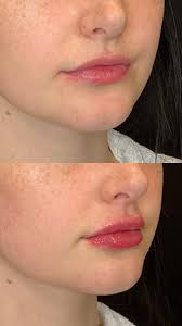 STL hasn't seen anything like it! RA Kirkwood grand opening ✨🖤