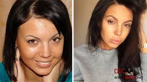 Новое шо / после интервью о вой / нет сил бороться»: Top 5 Rossijskih Krasotok Do I Posle Plastiki