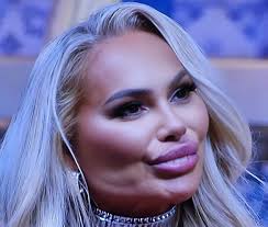 🚨🔥Darcey Silva's Stunning Transformation: Fans Say She No Longer  Resembles Twin Sister Stacey Silva‼️👀