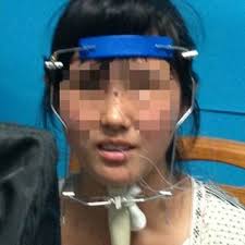 Tongue contour Tracking by Edgetrak