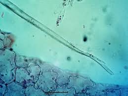 Image result for Coccinia barteri