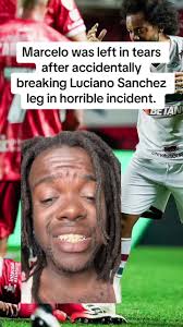 Luciano Sanchez Leg After Tackle