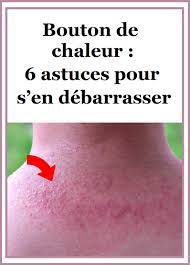 Ce mélange naturel va favoriser le sommeil grâce à la présence du miel de tilleul qui a des vertus apaisantes. Bouton De Chaleur 6 Astuces Pour S En Debarrasser Boutons De Chaleur Sante Et Beaute Bouton De Chaleur Visage