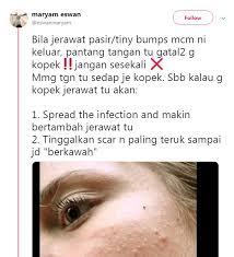 Ada beberapa tips hilangkan jerawat yang dapat anda lakukan. Maryam1 Hijabista