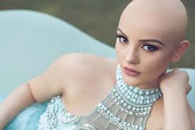 Vivir sin pelo: una modelo revela su historia en Instagram