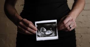 Image result for First Obstetric Visit