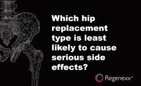 Maybe you would like to learn more about one of these? Hip Replacement Materials The Best Worst Kinds To Use