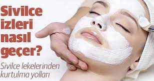 Sivilce Lekelerine Kesin Cozum Ibrahim Saracoglu Acikliyor Hatunzade Com Sleep Eye Mask Beauty Mask