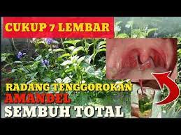Luar Biasa Radang Tenggorokan Amandel Sembuh Total Dengan Ramuan Herbal Ini Youtube Herbal Youtube Penyembuhan