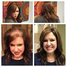 It's pervasive and it may be due to stress, using the incorrect products, menopause and perimenopause hair loss. Hairstyle Trends 30 Flattering Hairstyles For Thinning Hair That Ll Boost Volume Photos Co Thin Hair Styles For Women Thick Hair Styles Hair Pieces