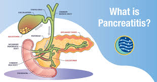 Image result for pancreas)