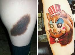 Birthmark Cover Up Tattoo Birthmark Camouflage Birthmark Tattoo Tattoos Hand Tattoos