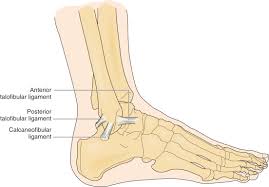 Although a medial malleolus fracture can be a serious injury, the outlook for recovery is good, and complications are rare. Ankle Sprain Musculoskeletal Key