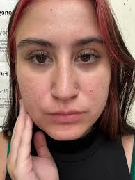 How do you say glowy, smoother skin? BAKUCHIOL! ✨ It's retinol but  better!🌻🌟 Glow up the natural and gentler way with the power of Sunflower  Beauty Oil enriched with the benefits of