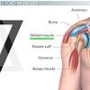 For that reason, and because of the dexterity of the shoulder joint. 1