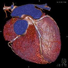 Sangele care pleaca de la inima se numeste sange arterial. Am Vorbit Cu Un Cardiolog ExplicaÈ›ie SimplÄƒ Despre Bolile De InimÄƒ Ce Le CauzeazÄƒ È™i Cum Pot Fi Depistate Nwradu Blog