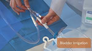 Image result for Continuous Bladder Irrigation