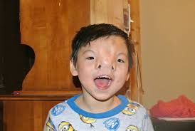 Navigating the Stillness ....: Surgery preparation, comparison and  explanation **Some Graphic Photos**