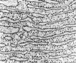 What is difference between rough and smooth endoplasmic reticulum. How Does Rough Endoplasmic Reticulum Differ From Smooth Endoplasmic Reticulum Socratic