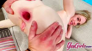 Wild blondes anal gape and asshole fisting