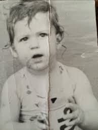 Can crease scar be removed from photo?