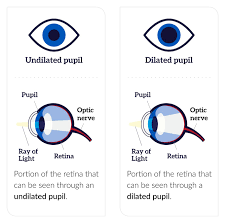 Get A Dilated Eye Exam National Eye Institute
