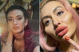 Anastasia pokreshchuk, 39 from kiev, ukraine, used to have a slender face and curly hair in her. Instagram Model With Biggest Cheeks In The World Wants More