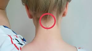 Mein Nacken Knackt Oder Was Ist Das Kopf Knochen Knacken