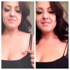 How to cover up a hickey with makeup? How To Cover A Hickey With Makeup Pattiknows Patti Stanger