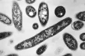 Third death in NYC Legionnaires’ outbreak: Health Department