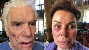 He is an actor, known for commissaire valence (2003), hommes, femmes, mode d'emploi. Die Schockierenden Fotos Von Bernard Tapie Und Seiner Frau Nach Einem Brutalen Uberfall Am Wochenende Nachrichten Fr