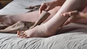 Can Treatments Ease Lymphedema Symptoms? | News | Yale Medicine