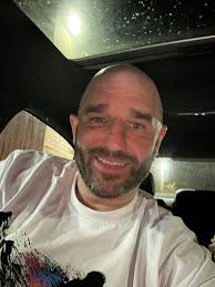 What ideas can help with hair loss?